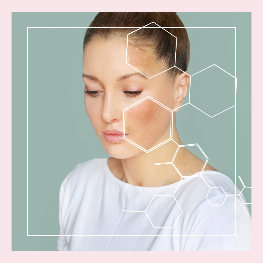 SkinPen: Non-Ableative, No Thermal Energy Required